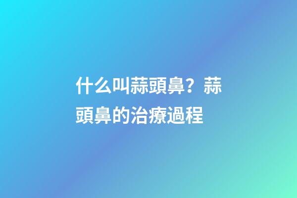 什么叫蒜頭鼻？蒜頭鼻的治療過程