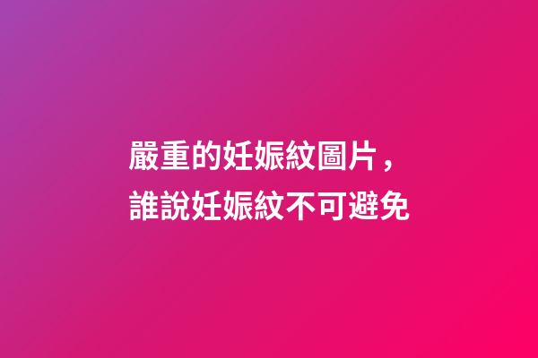 嚴重的妊娠紋圖片，誰說妊娠紋不可避免-第1張-觀點-玄機派