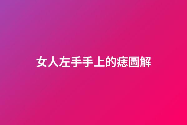 女人左手手上的痣圖解