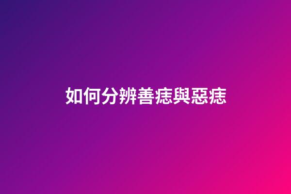 如何分辨善痣與惡痣