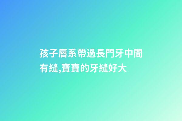 孩子唇系帶過長門牙中間有縫,寶寶的牙縫好大-第1張-觀點(diǎn)-玄機(jī)派