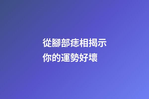 從腳部痣相揭示你的運勢好壞