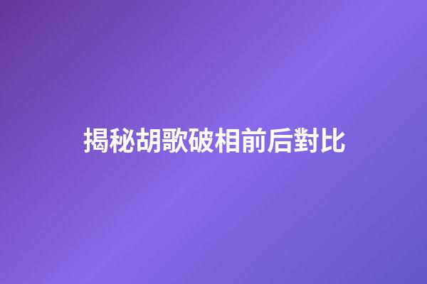 揭秘胡歌破相前后對比