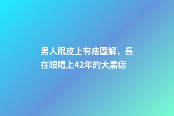 男人眼皮上有痣圖解，長在眼睛上42年的大黑痣-第1張-觀點(diǎn)-玄機(jī)派