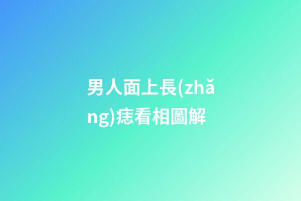 男人面上長(zhǎng)痣看相圖解
