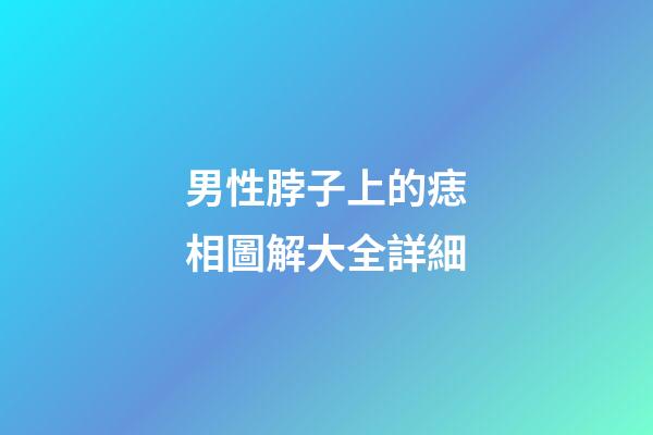 男性脖子上的痣相圖解大全詳細