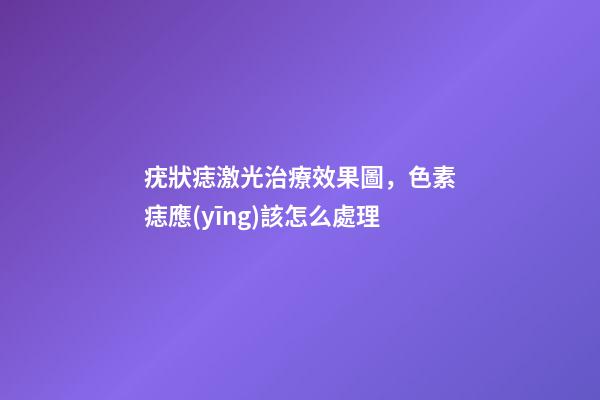 疣狀痣激光治療效果圖，色素痣應(yīng)該怎么處理-第1張-觀點(diǎn)-玄機(jī)派