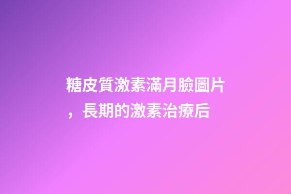 糖皮質激素滿月臉圖片，長期的激素治療后-第1張-觀點-玄機派