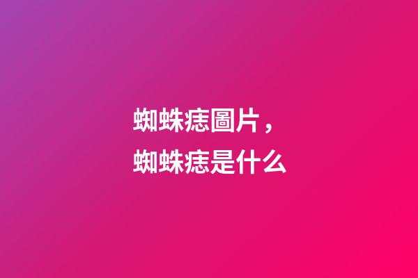 蜘蛛痣圖片，蜘蛛痣是什么